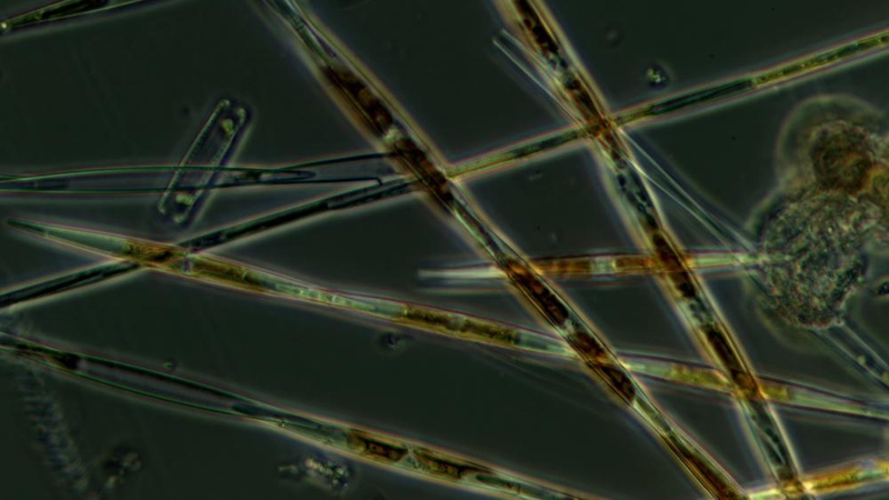 Photo of diatoms of the genus Pseudo-nitzschia.